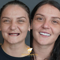 EstheDental - Cosmetic Dentistry in Turkey