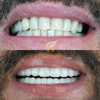 EstheDental - Cosmetic Dentistry in Turkey