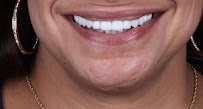 EstheDental - Cosmetic Dentistry in Turkey