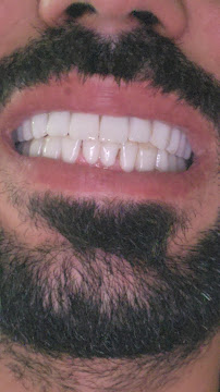 EstheDental - Cosmetic Dentistry in Turkey