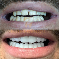 EstheDental - Cosmetic Dentistry in Turkey