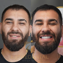 EstheDental - Cosmetic Dentistry in Turkey