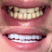 EstheDental - Cosmetic Dentistry in Turkey