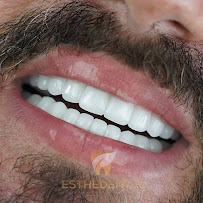 EstheDental - Cosmetic Dentistry in Turkey