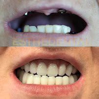 EstheDental - Cosmetic Dentistry in Turkey