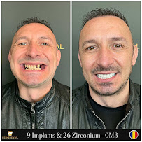 EstheDental - Cosmetic Dentistry in Turkey