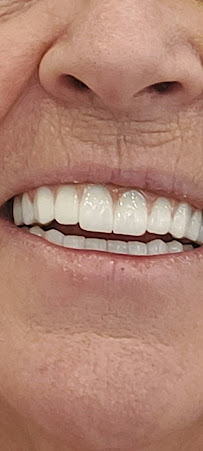 Parla Clinic Nişantaşı