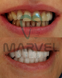 Marvel Dental Clinic