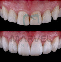 Marvel Dental Clinic