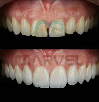 Marvel Dental Clinic