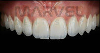 Marvel Dental Clinic Istanbul in Istanbul