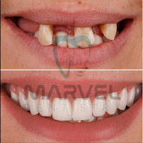 Marvel Dental Clinic