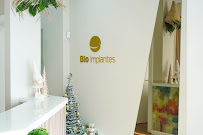 BioImplantes