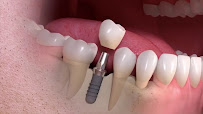 Implant Center Frankić - dental clinic