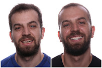 Implant Dental Centar Ružević