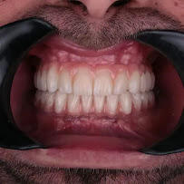 Implant Dental Centar Ružević