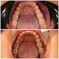 Implant Dental Centar Ružević