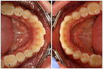 Implant Dental Centar Ružević