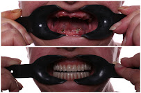 Implant Dental Centar Ružević
