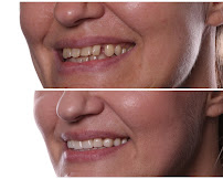 Implant Dental Centar Ružević