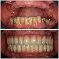 Implant Dental Centar Ružević