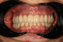 Implant Dental Centar Ružević