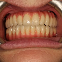 Implant Dental Centar Ružević