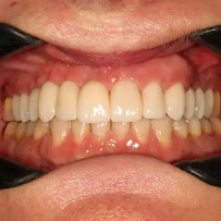 Implant Dental Centar Ružević