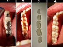 Dr Blazenka Bilandzic - SPLIT DENT