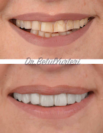 Dentart Diş Kliniği- Koşuyolu-Diş Estetiği-Dental Clinic-Implant & Esthetic Dentistry