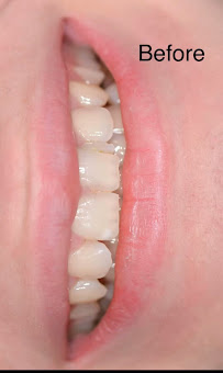 Dentart Diş Kliniği- Koşuyolu-Diş Estetiği-Dental Clinic-Implant & Esthetic Dentistry