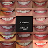 Dentart Diş Kliniği- Koşuyolu-Diş Estetiği-Dental Clinic-Implant & Esthetic Dentistry
