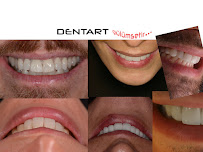 Dentart Diş Kliniği- Koşuyolu-Diş Estetiği-Dental Clinic-Implant & Esthetic Dentistry
