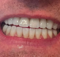 Dentvitalis - Dentisti Croazia