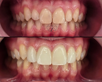 Zdental Ordinacija