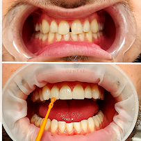 Zdental Ordinacija