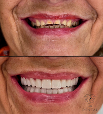 Zdental Ordinacija