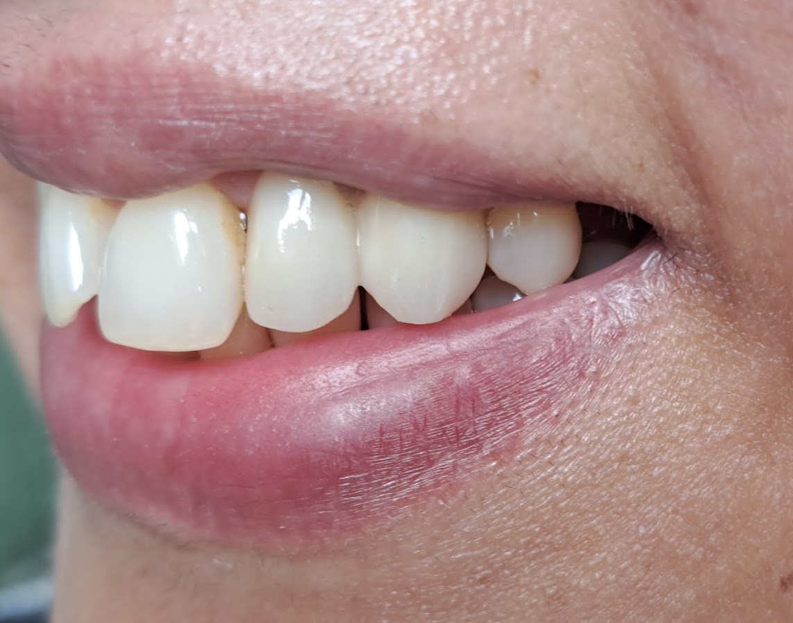 Dental Office Studio Stradiot - dental clinic in Rijeka