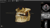Centrodent - stomatološka ordinacija | zubna ordinacija | Zubar Rijeka | Zubar Kastav | Dentista Croazia