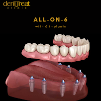 DentTreat
