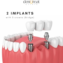 DentTreat