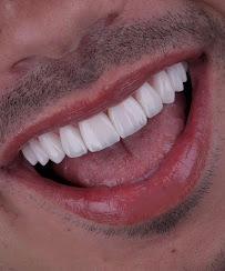 Diş Kliniği Postmodern | Dentist | Dental Clinic | Hollywood Smile Center
