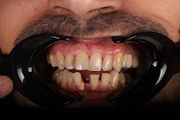 Diş Kliniği Postmodern | Dentist | Dental Clinic | Hollywood Smile Center