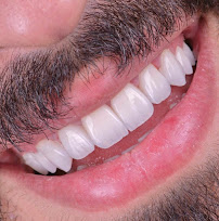 Diş Kliniği Postmodern | Dentist | Dental Clinic | Hollywood Smile Center