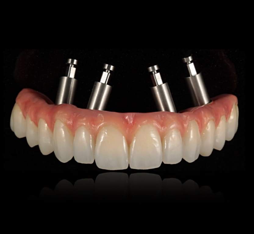 Dental Crepulja - dental clinic in Rijeka