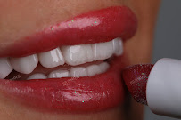 Biu Smile