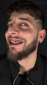 Biu Smile