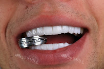 Biu Smile