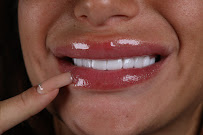 Biu Smile