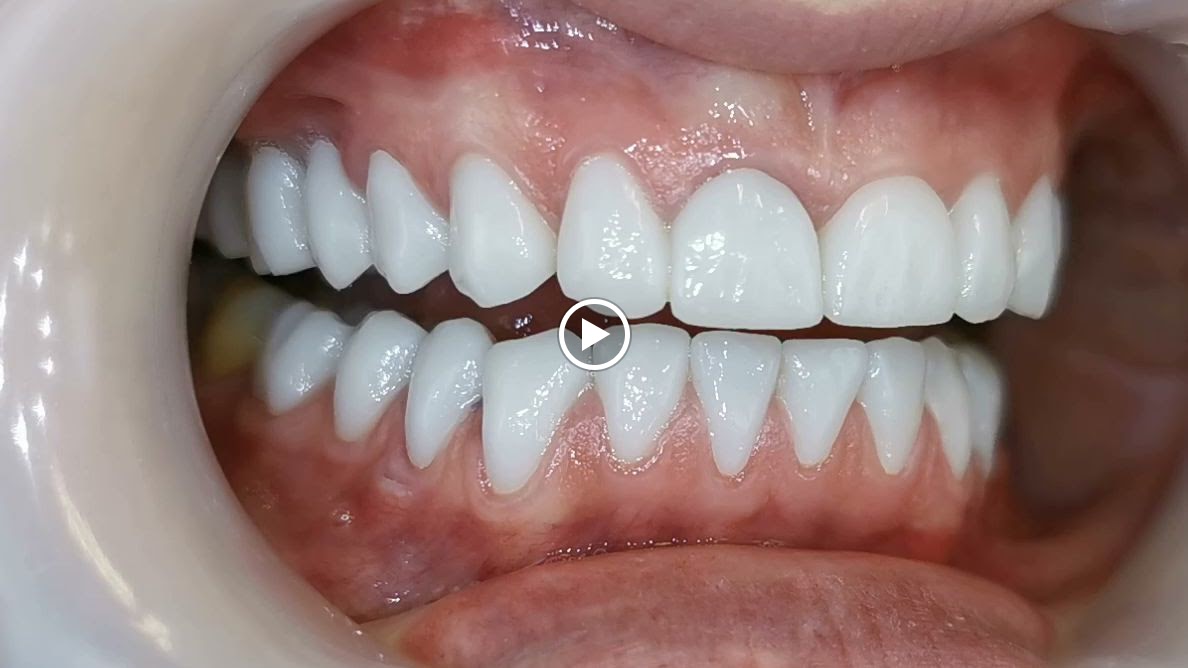 Dental - Poliklinika Visodent - dental clinic in Zagreb, Croatia